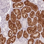 Immunohistochemical staining of human kidney shows strong cytoplasmic positivity in cells in tubules.