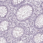 Immunohistochemical staining of human colon shows no cytoplasmic positivity in glandular cells as expected.