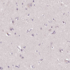 Immunohistochemical staining of human cerebral cortex shows no cytoplasmic positivity in neuronal cells as expected.