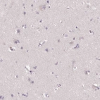 Immunohistochemical staining of human cerebral cortex shows no cytoplasmic positivity in neuronal cells as expected.