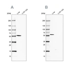 Western blot analysis using Anti-FTCD antibody HPA030929 (A) shows similar pattern to independent antibody HPA030928 (B).