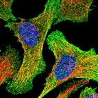 Immunofluorescent staining of human cell line U-2 OS shows localization to plasma membrane & cytosol.