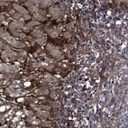 Anti-COL18A1 Antibody