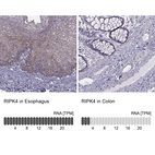 Anti-RIPK4 Antibody