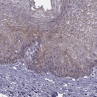 Immunohistochemical staining of human esophagus shows high expression.