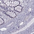 Immunohistochemical staining of human colon shows low expression as expected.