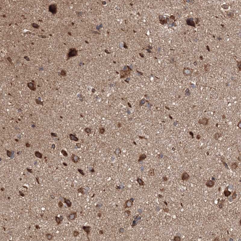 Anti-BRWD1 Antibody
