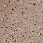 Anti-BRWD1 Antibody