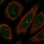 Immunofluorescent staining of human cell line SiHa shows localization to nucleoli & cytosol.