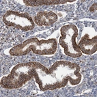 Immunohistochemical staining of human Endometrium shows strong cytoplasmic positivity in glandular cells.