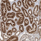 Immunohistochemical staining of human Kidney shows strong cytoplasmic positivity in cells in tubules.