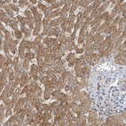 Immunohistochemical staining of human Liver shows strong cytoplasmic positivity in hepatocytes.