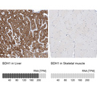 Anti-BDH1 Antibody