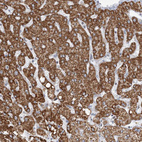 Immunohistochemical staining of human liver shows strong cytoplasmic granular positivity in hepatocytes.
