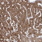 Immunohistochemical staining of human liver shows strong cytoplasmic granular positivity in hepatocytes.