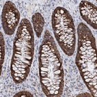 Anti-BDH1 Antibody