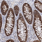 Immunohistochemical staining of human rectum shows strong cytoplasmic granular positivity in glandular cells.