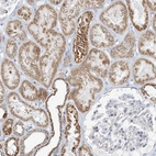 Immunohistochemical staining of human kidney shows moderate cytoplasmic granular positivity in cells in tubules.