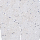 Immunohistochemical staining of human skeletal muscle shows no positivity in myocytes as expected.