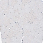 Immunohistochemical staining of human skeletal muscle shows no positivity in myocytes as expected.