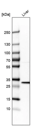 Western blot analysis in human liver tissue.