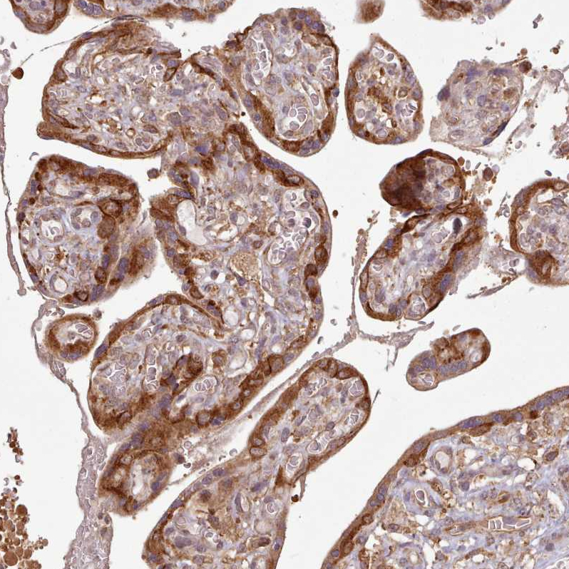 Anti-AIM1 Antibody