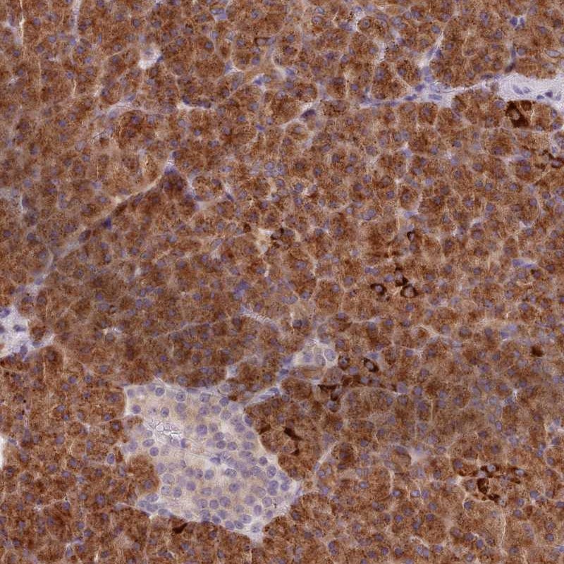 Anti-AIM1 Antibody
