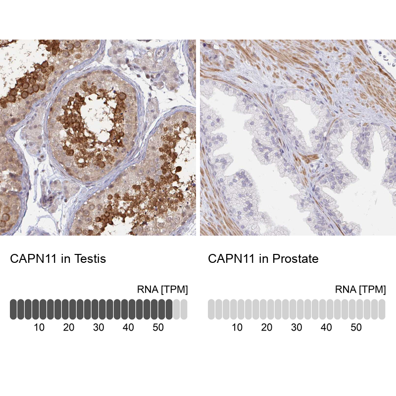 Anti-CAPN11 Antibody