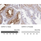 Anti-CAPN11 Antibody