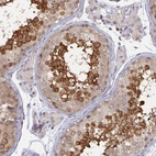 Immunohistochemical staining of human testis shows high expression.