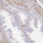 Immunohistochemical staining of human prostate shows low expression as expected.