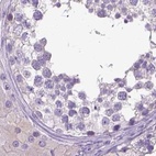Immunohistochemical staining of human testis using Anti-LGSN antibody HPA030957.