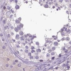 Immunohistochemical staining of human testis using Anti-LGSN antibody HPA030957.
