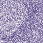 Immunohistochemical staining of human lymph node using Anti-LGSN antibody HPA030957.