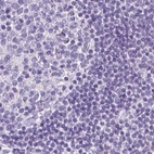 Immunohistochemical staining of human lymph node using Anti-LGSN antibody HPA030957.