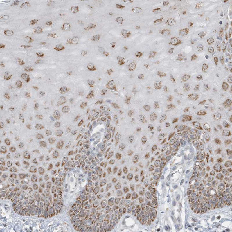 Anti-FNDC1 Antibody