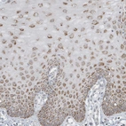 Anti-FNDC1 Antibody
