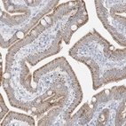 Immunohistochemical staining of human duodenum shows moderate granular cytoplasmic positivity in glandular cells.