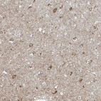 Immunohistochemical staining of human cerebral cortex shows moderate granular cytoplasmic positivity in neurons.