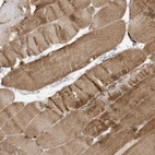Immunohistochemical staining of human skeletal muscle shows moderate cytoplasmic positivity in myocytes.