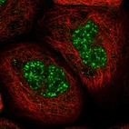 Immunofluorescent staining of human cell line A-431 shows localization to nuclear speckles.