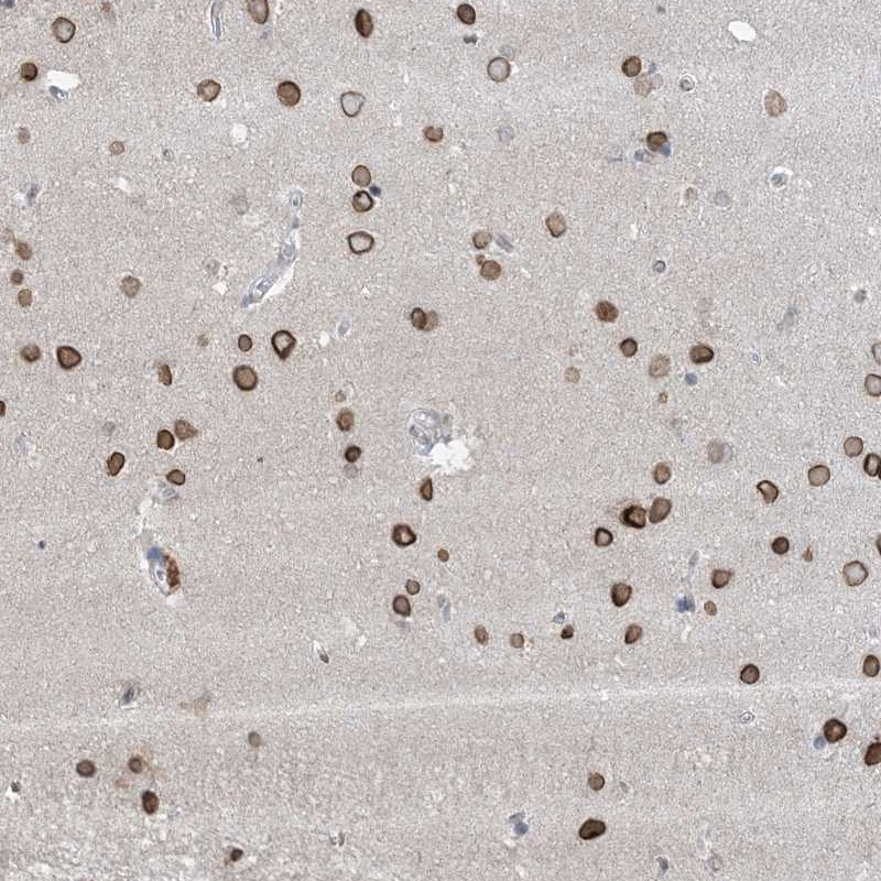 Anti-FNDC1 Antibody