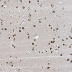 Anti-FNDC1 Antibody