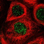 Immunofluorescent staining of human cell line A-431 shows localization to nuclear speckles.