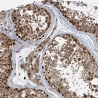 Anti-ZNF507 Antibody