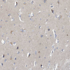 Immunohistochemical staining of human cerebral cortex shows weak positivity in neurons.
