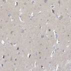 Immunohistochemical staining of human cerebral cortex shows weak positivity in neurons.