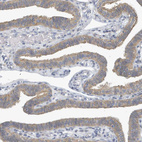 Immunohistochemical staining of human fallopian tube shows moderate cytoplasmic positivity in glandular cells.