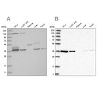 Western blot analysis using Anti-VTA1 antibody HPA030968 (A) shows similar pattern to independent antibody HPA030969 (B).