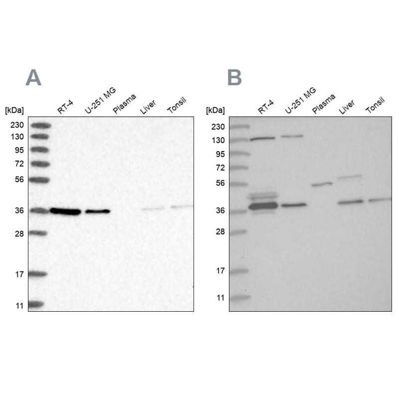 Anti-VTA1 Antibody